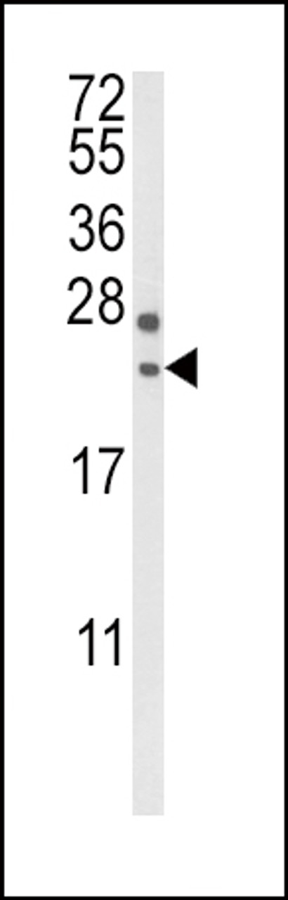 Western blot analysis of RGS4 Antibody in mouse brain tissue lysates (35ug/lane)