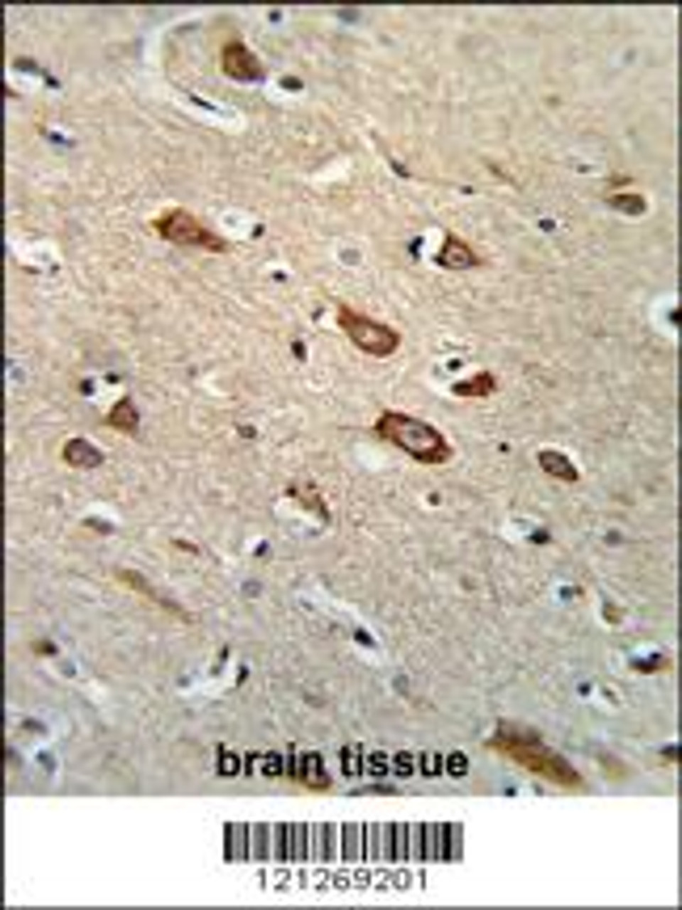 Formalin-fixed and paraffin-embedded human brain tissue reacted with TCERG1L Antibody, which was peroxidase-conjugated to the secondary antibody, followed by DAB staining.