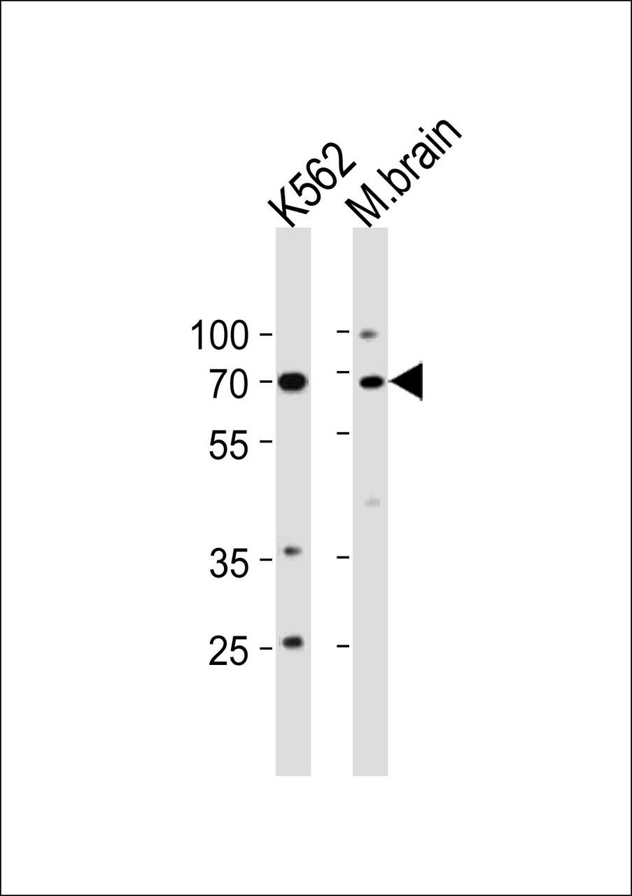 Western blot analysis in K562 cell line and mouse brain tissue lysates (35ug/lane) .