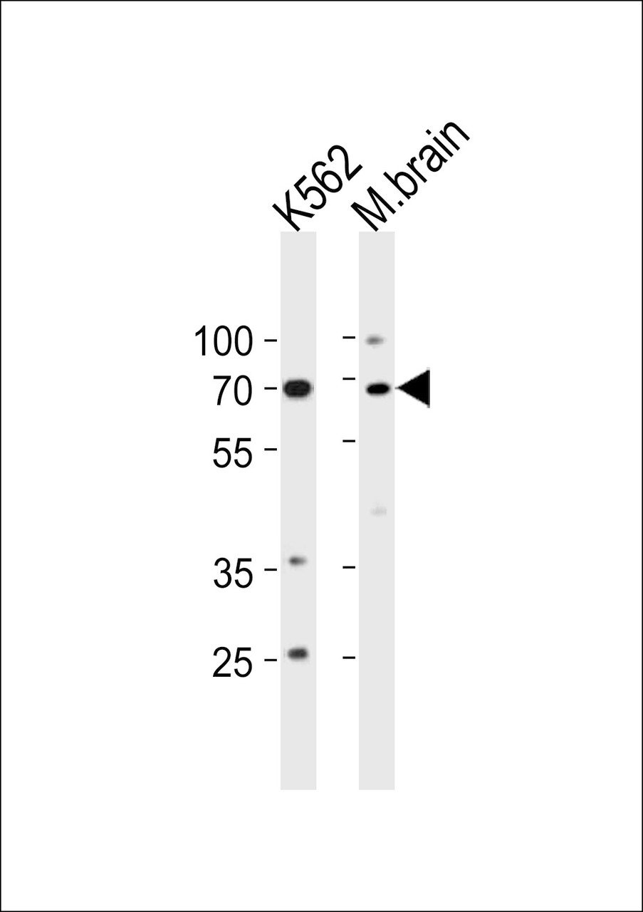 Western blot analysis in K562 cell line and mouse brain tissue lysates (35ug/lane) .