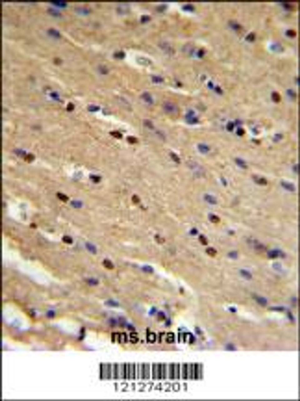 TP73 Antibody IHC analysis in formalin fixed and paraffin embedded mouse brain followed by peroxidase conjugation of the secondary antibody and DAB staining.