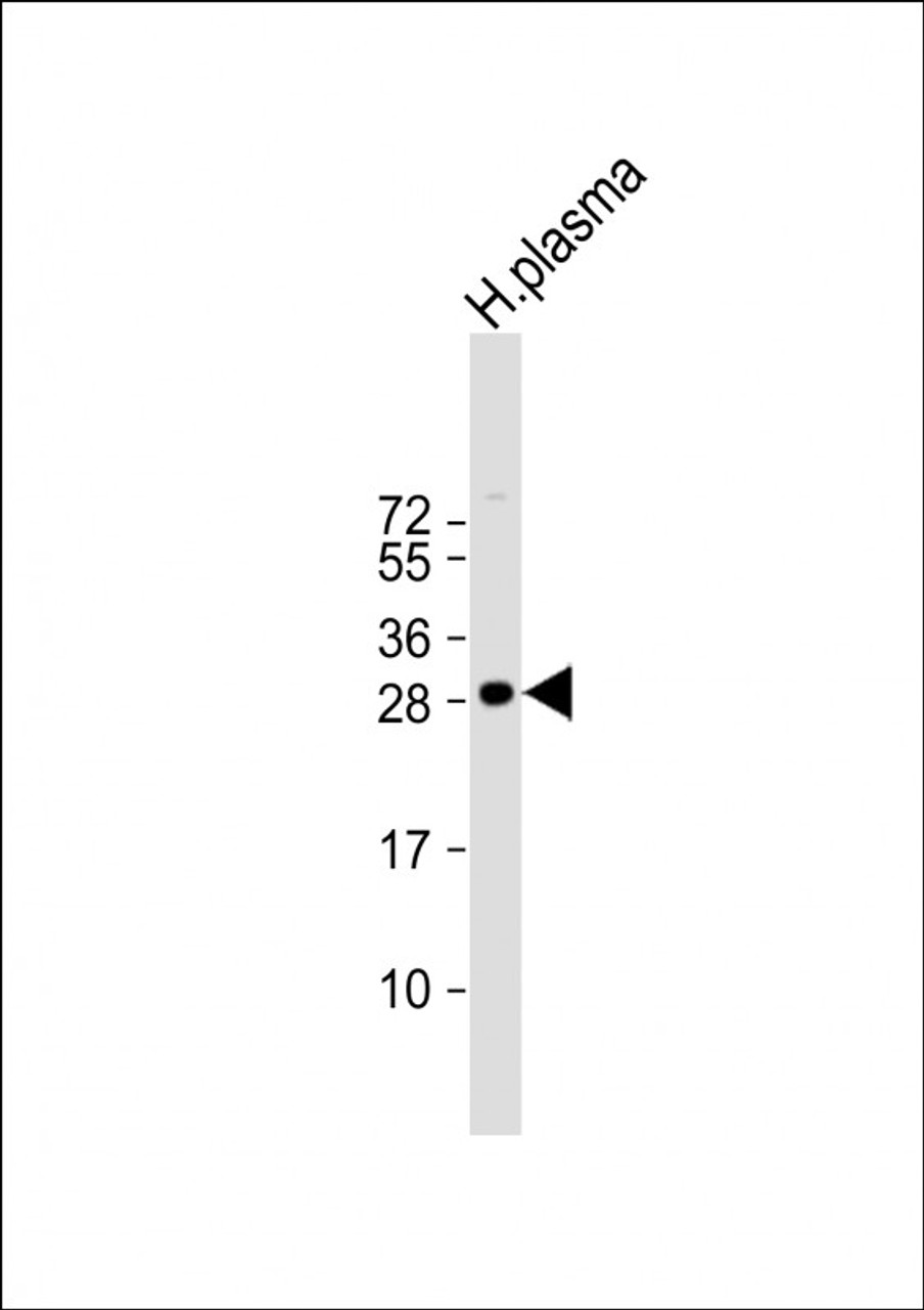 Western Blot at 1:1000 dilution + human plasma lysate Lysates/proteins at 20 ug per lane.