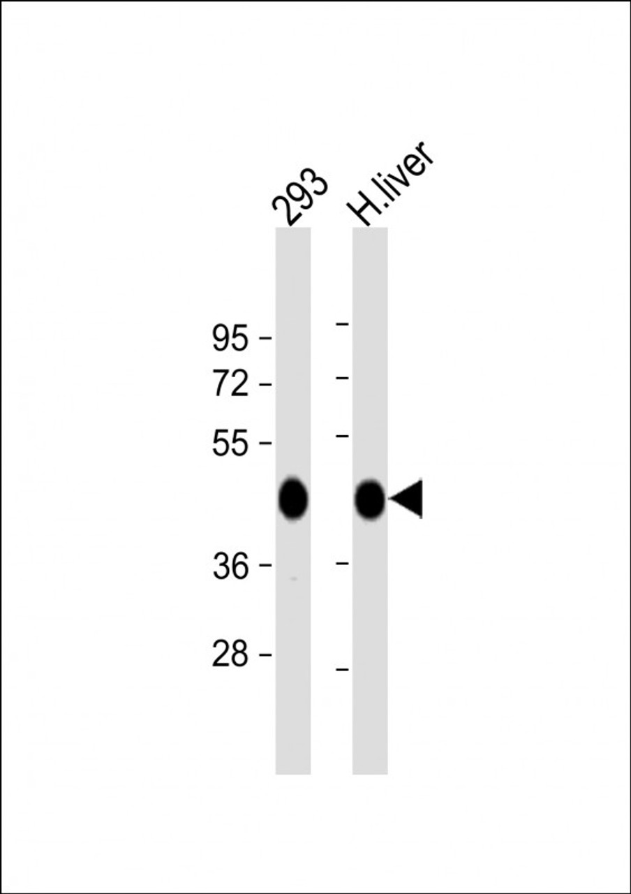 Western Blot at 1:1000 dilution Lane 1: 293 whole cell lysate Lane 2: human liver lysate Lysates/proteins at 20 ug per lane.