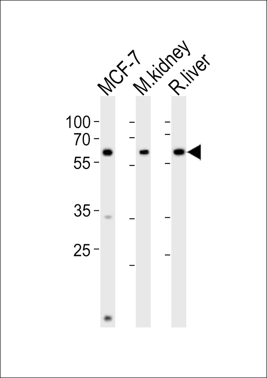 Western blot analysis of lysates from MCF-7 cell line, mouse kidney, rat liver tissue (from left to right) , using GCGR Antibody at 1:1000 at each lane.