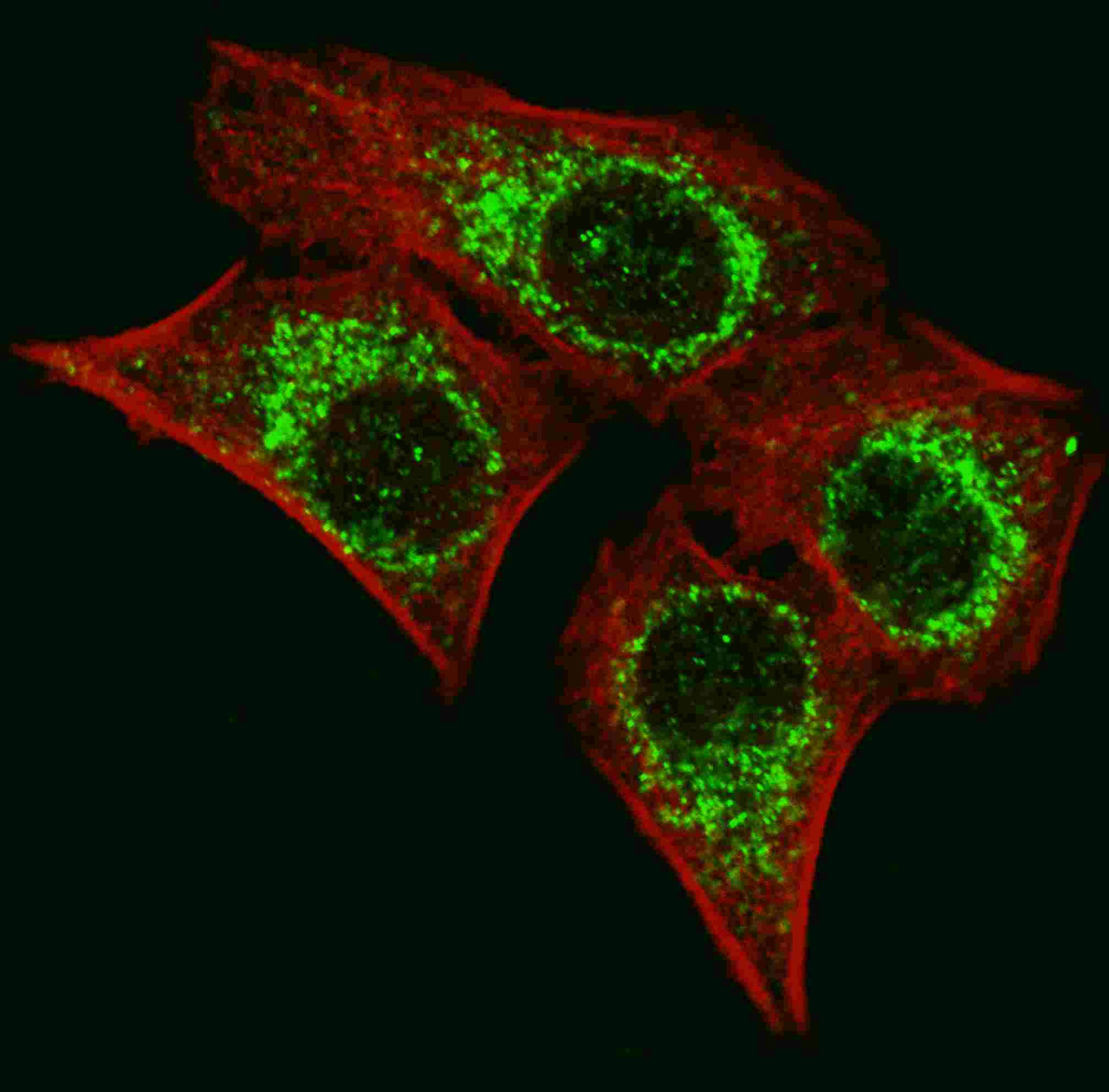 Fluorescent image of U251 cells stained with AIFM1 antibody. U251 cells were fixed with 4% PFA (20 min) , permeabilized with Triton X-100 (0.2%, 30 min) . Cells were then incubated with AIFM1 primary antibody (1:200, 2 h at room temperature) . For secondary antibody, Alexa Fluor 488 conjugated donkey anti-rabbit antibody (green) was used (1:1000, 1h) . Cytoplasmic actin was counterstained with Alexa Fluor 555 (red) conjugated Phalloidin (5.25 uM, 25 min) . Pictures were taken on a Biorevo microscope (BZ-900, Keyence) . Nuclei were counterstained with Hoechst 33342 (blue) (10 ug/ml, 5 min) . AIFM1 immunoreactivity is localized to the cytoplasm of U251 cells.