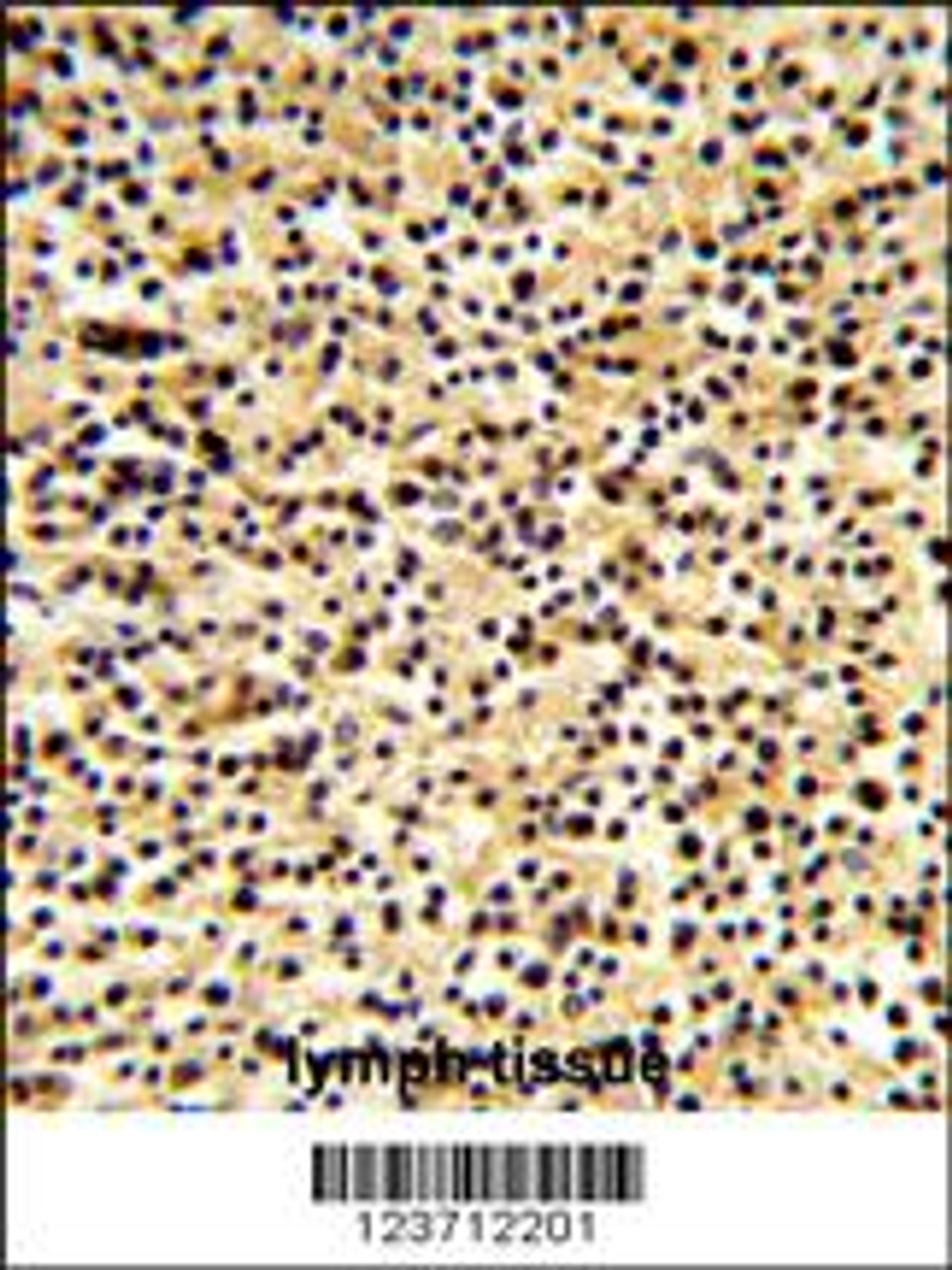 Formalin-fixed and paraffin-embedded human lymph tissue reacted with DTX1 Antibody, which was peroxidase-conjugated to the secondary antibody, followed by DAB staining.