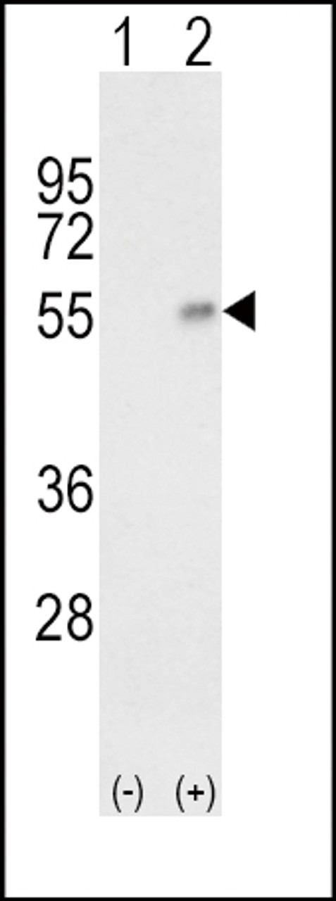 Western blot analysis of HP using rabbit polyclonal HP Antibody using 293 cell lysates (2 ug/lane) either nontransfected (Lane 1) or transiently transfected with the HP gene (Lane 2) .