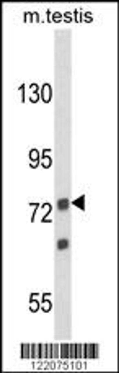 Western blot analysis of ANGEL1 Antibody in mouse testis tissue lysates (35ug/lane)