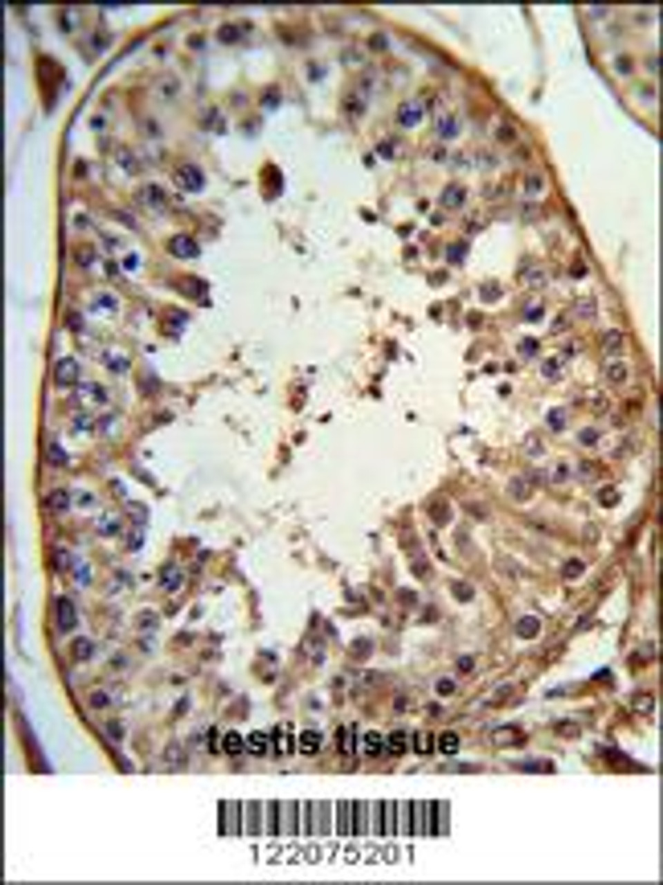 Formalin-fixed and paraffin-embedded human testis tissue reacted with ANGEL1 Antibody, which was peroxidase-conjugated to the secondary antibody, followed by DAB staining.