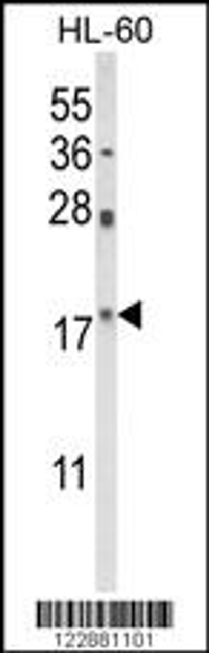 Western blot analysis of PIN1 Antibody in HL-60 cell line lysates (35ug/lane)