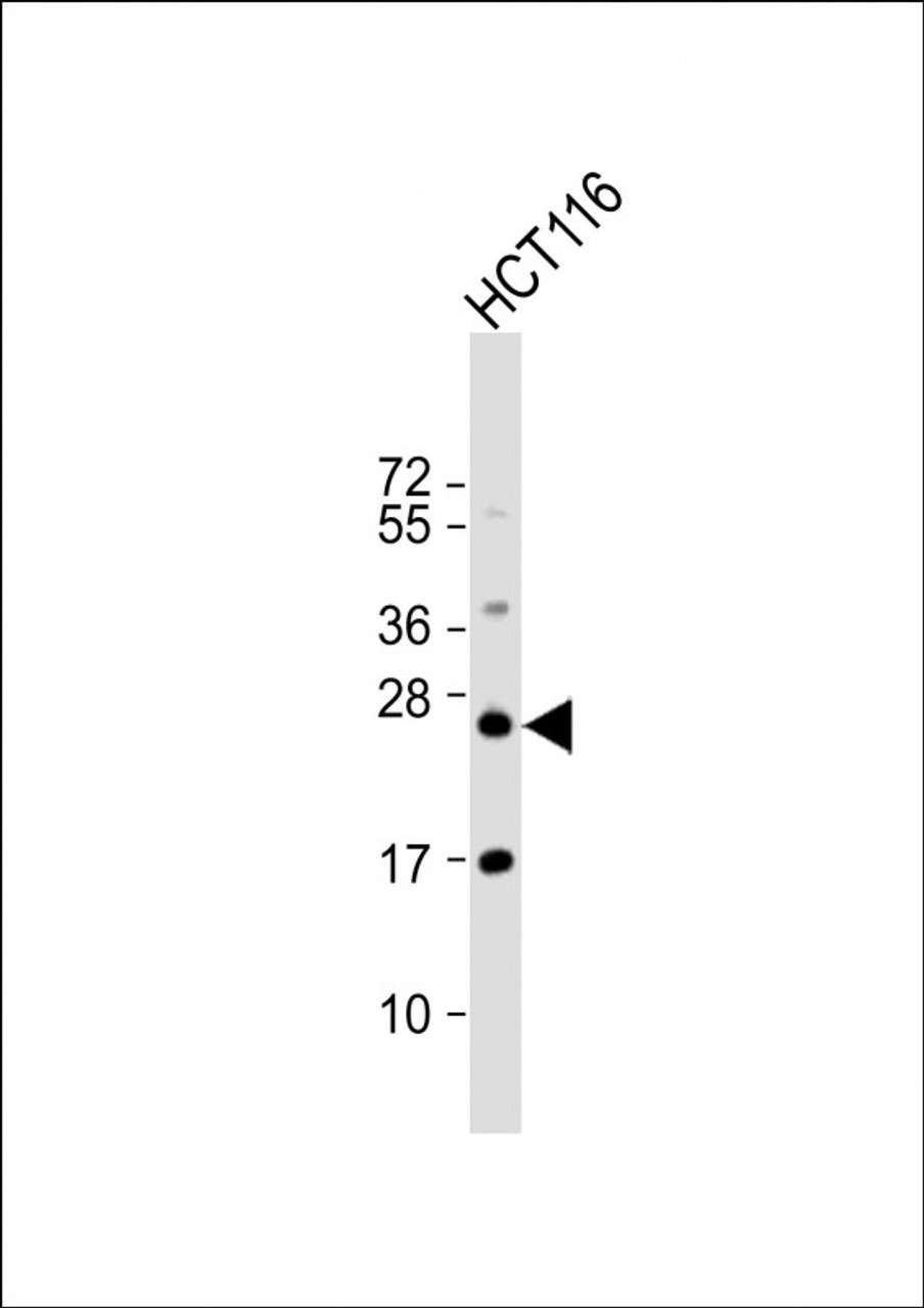 Western Blot at 1:1000 dilution + HCT116 whole cell lysate Lysates/proteins at 20 ug per lane.