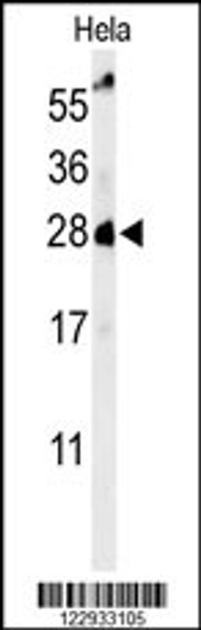 Western blot analysis of RAB8A Antibody in Hela cell line lysates (35ug/lane)