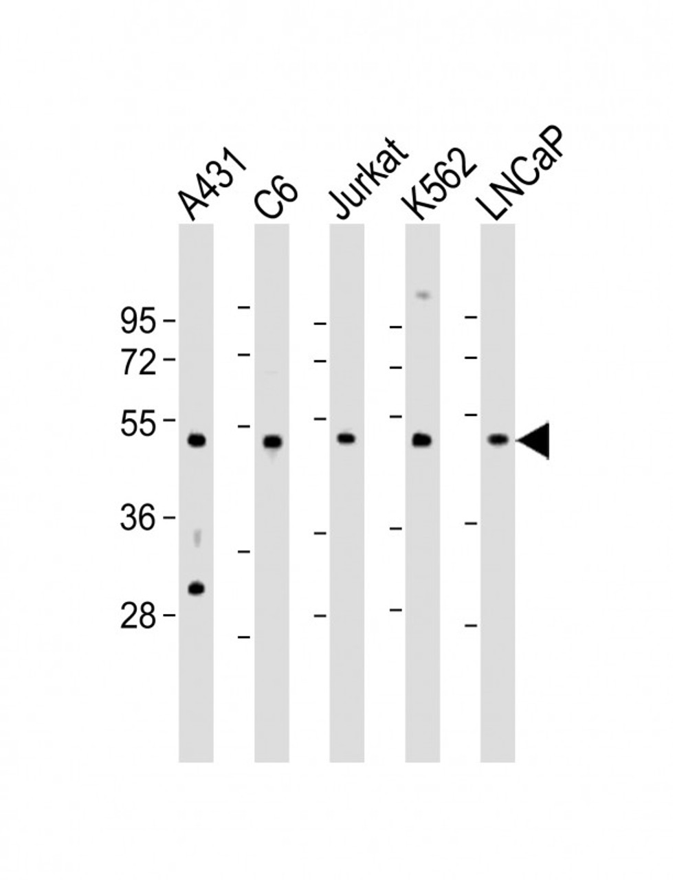 Western Blot at 1:2000 dilution Lane 1: A431 whole cell lysate Lane 2: C6 whole cell lysate Lane 3: Jurkat whole cell lysate Lane 4: K562 whole cell lysate Lane 5: LNCaP whole cell lysate Lysates/proteins at 20 ug per lane.