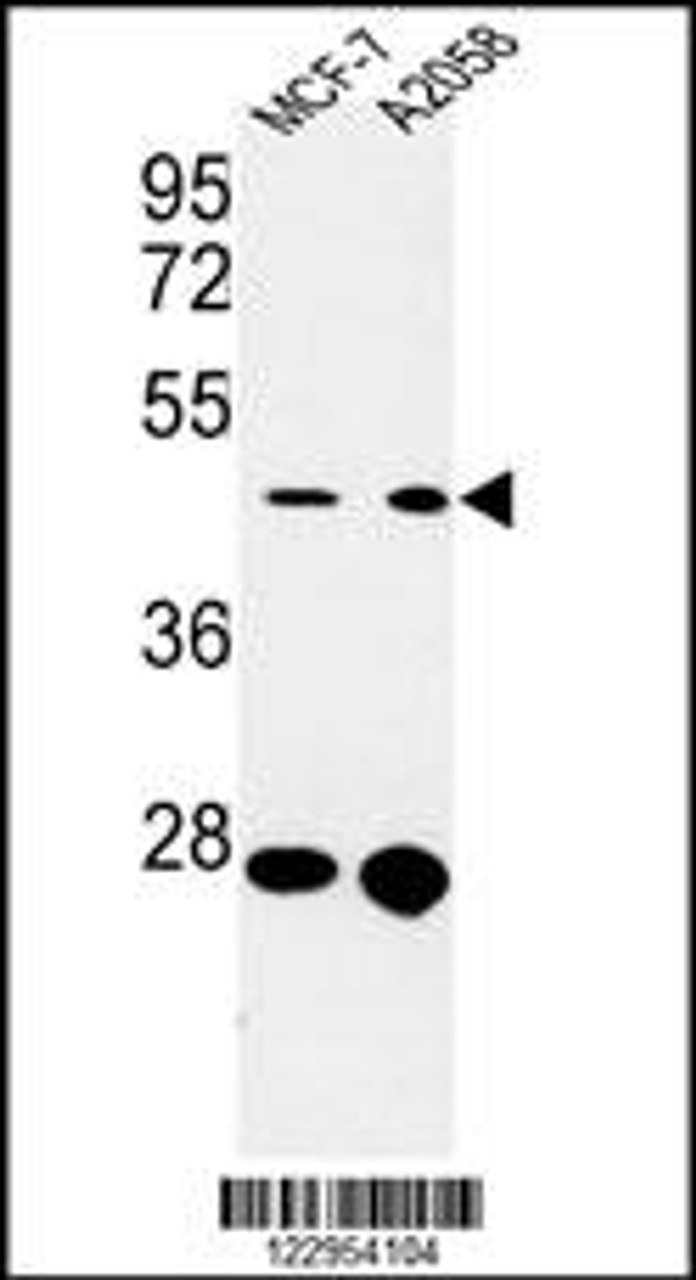 Western blot analysis of CDC37 Antibody in MCF-7, A2058 cell line lysates (35ug/lane)