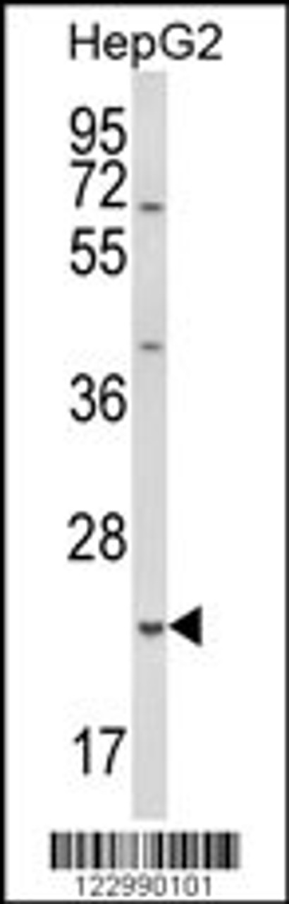 Western blot analysis of GSTA4 Antibody in HepG2 cell line lysates (35ug/lane)