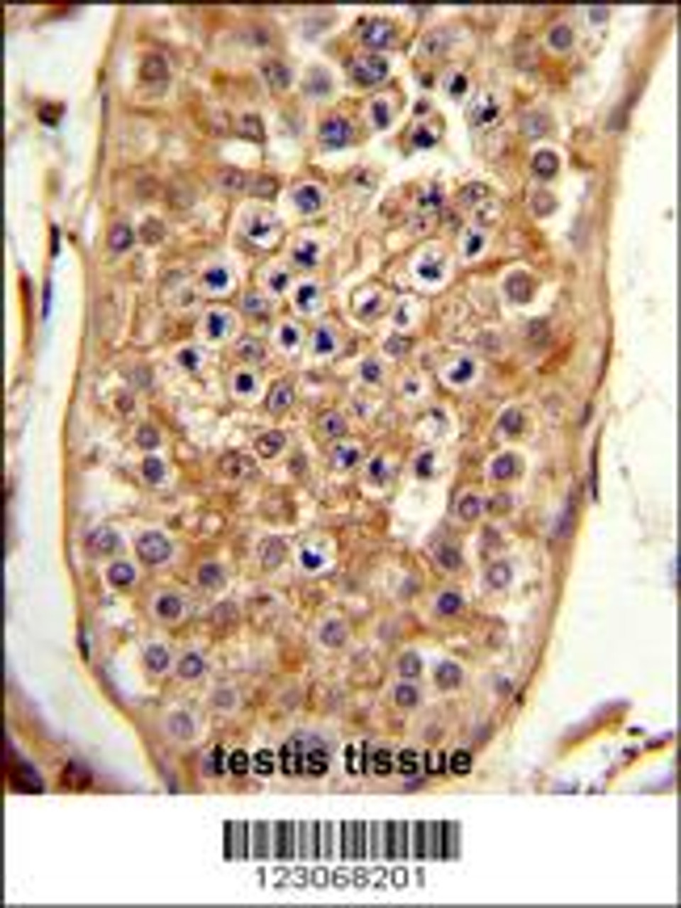 Formalin-fixed and paraffin-embedded human testis tissue reacted with C15orf2 Antibody, which was peroxidase-conjugated to the secondary antibody, followed by DAB staining.