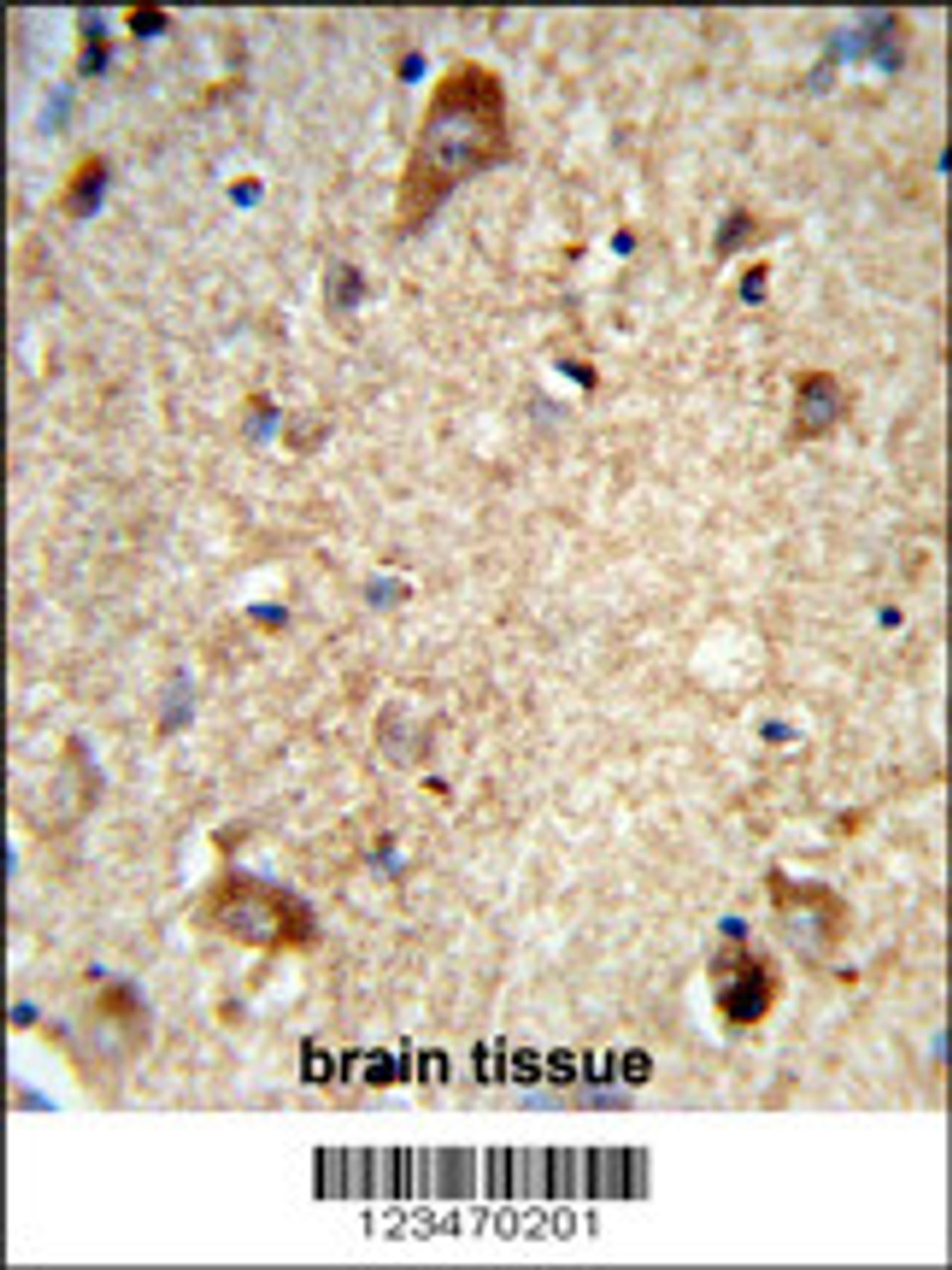Formalin-fixed and paraffin-embedded human brain tissue reacted with DAB1 Antibody, which was peroxidase-conjugated to the secondary antibody, followed by DAB staining.