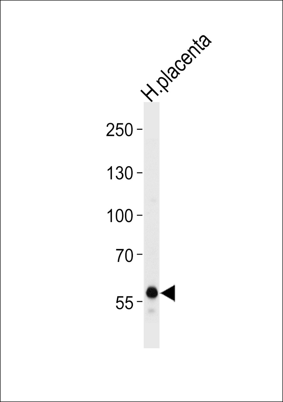 Western blot analysis of lysate from human placenta tissue lysate, using DAB2 Antibody at 1:1000 at each lane.