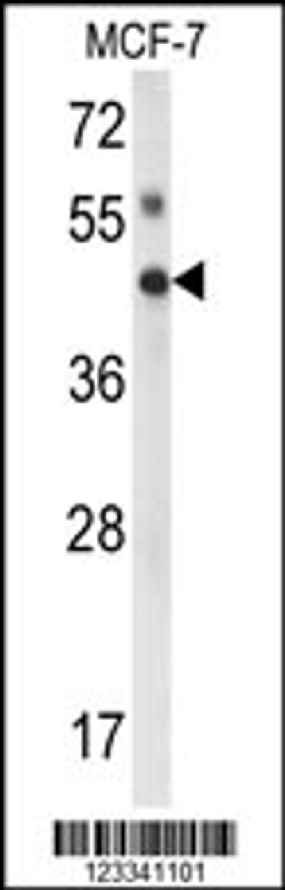 Western blot analysis of IPMK Antibody in MCF-7 cell line lysates (35ug/lane)