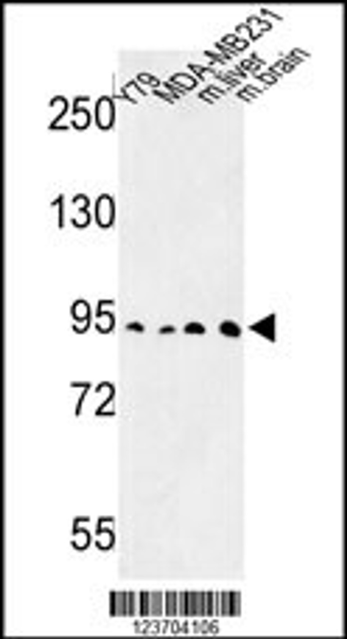 Western blot analysis of DPP10 Antibody in Y79, MDA-MB231 cell line and mouse liver, brain tissue lysates (35ug/lane)