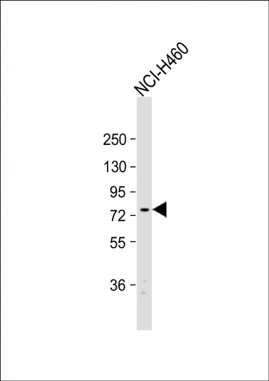 Western Blot at 1:1000 dilution + NCI-H460 whole cell lysate Lysates/proteins at 20 ug per lane.