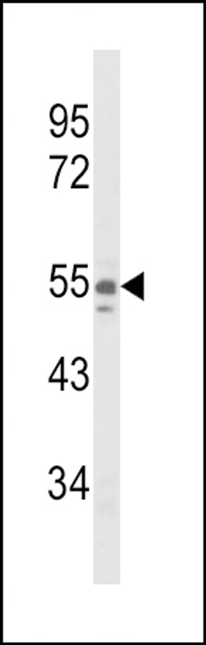 Western blot analysis of NAMPT Antibody in A375 cell line lysates (35ug/lane)