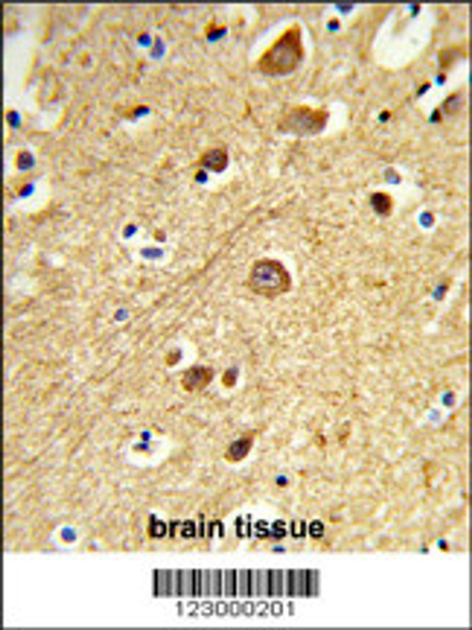 Formalin-fixed and paraffin-embedded human brain tissue reacted with JIP1 Antibody, which was peroxidase-conjugated to the secondary antibody, followed by DAB staining.