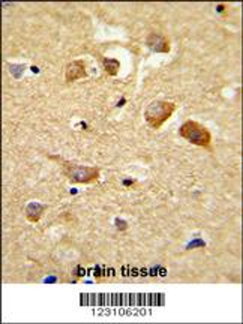Formalin-fixed and paraffin-embedded human brain tissue reacted with C6orf170 Antibody (N-term) , which was peroxidase-conjugated to the secondary antibody, followed by DAB staining.