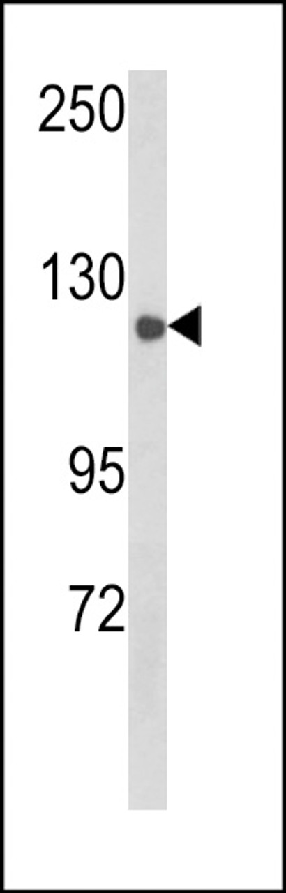 Western blot analysis of CLASP2 Antibody (Y1019) in mouse spleen tissue lysates (35ug/lane)