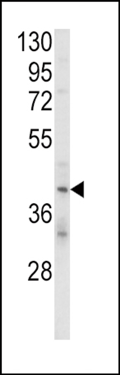 Western blot analysis of KIR2DL4 Antibody in MDA-MB231 cell line lysates (35ug/lane)