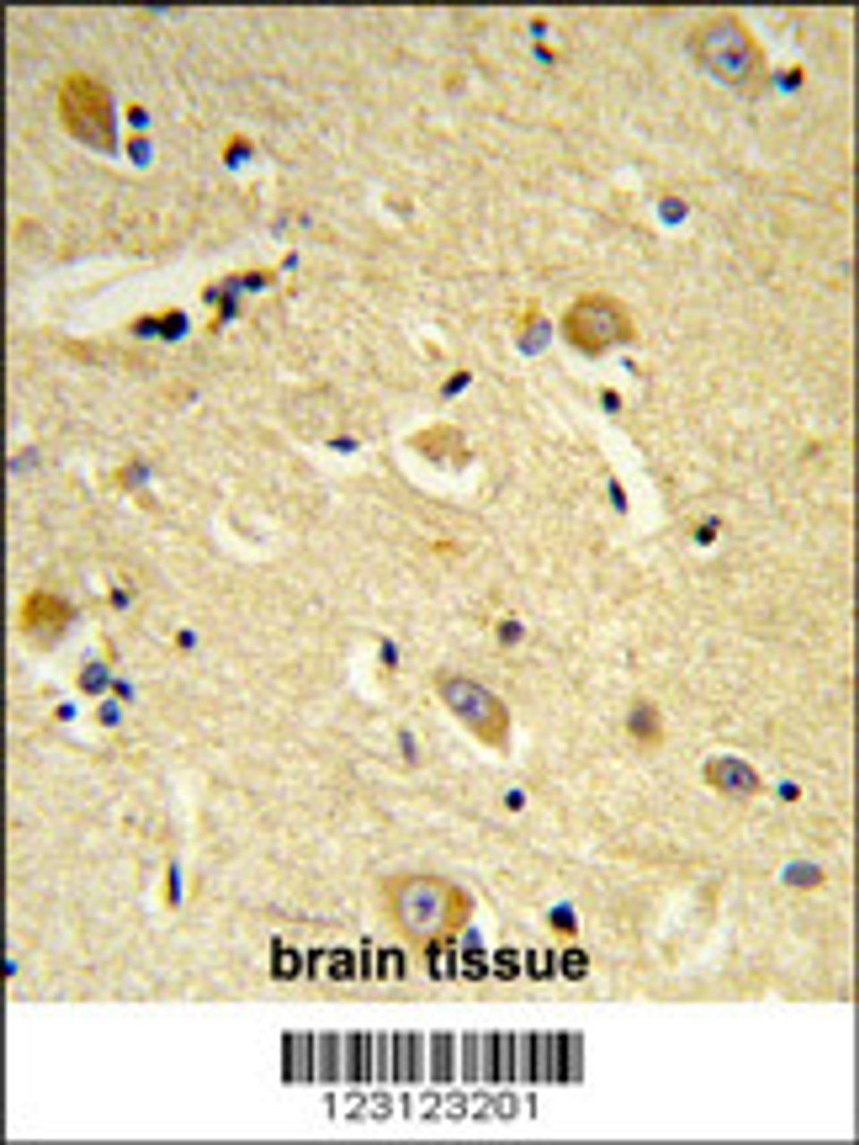 Formalin-fixed and paraffin-embedded human brain tissue reacted with CDIPT Antibody, which was peroxidase-conjugated to the secondary antibody, followed by DAB staining.