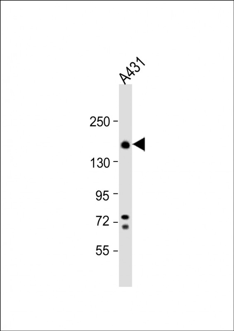 Western Blot at 1:1000 dilution + A431 whole cell lysate Lysates/proteins at 20 ug per lane.