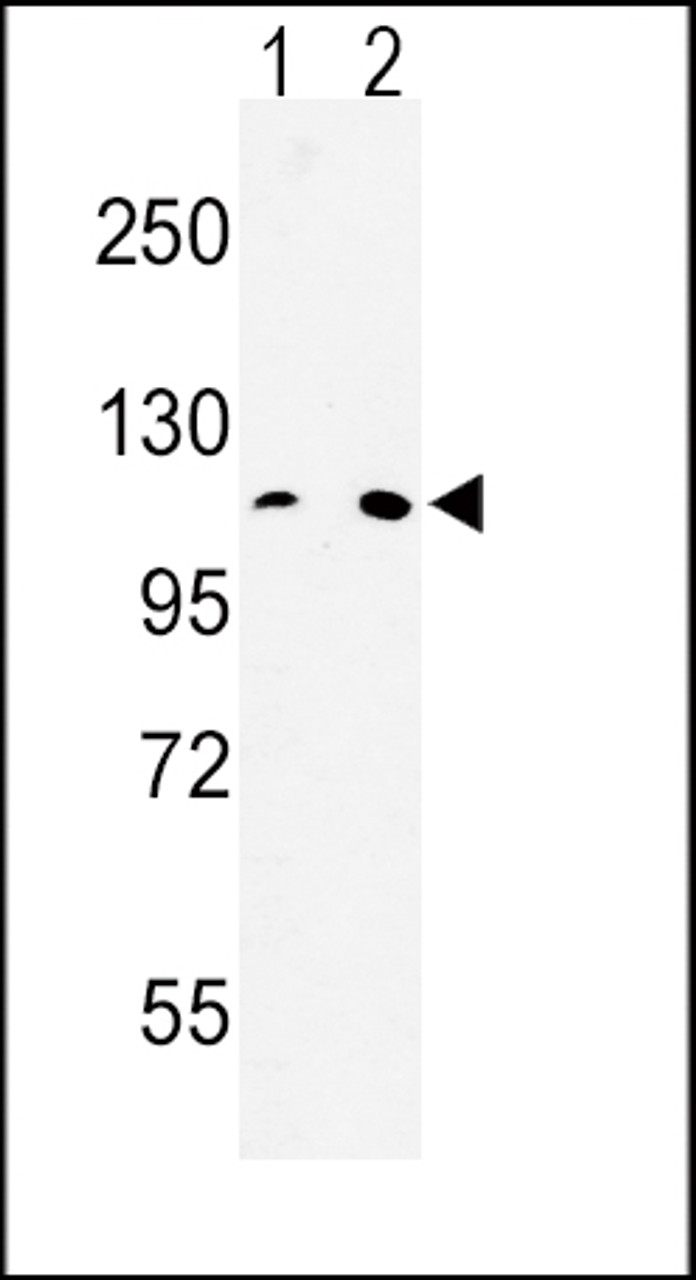 Western blot analysis of MTTP Antibody in Hela (lane 1) , 293 (lane 2) cell line lysates (35ug/lane)