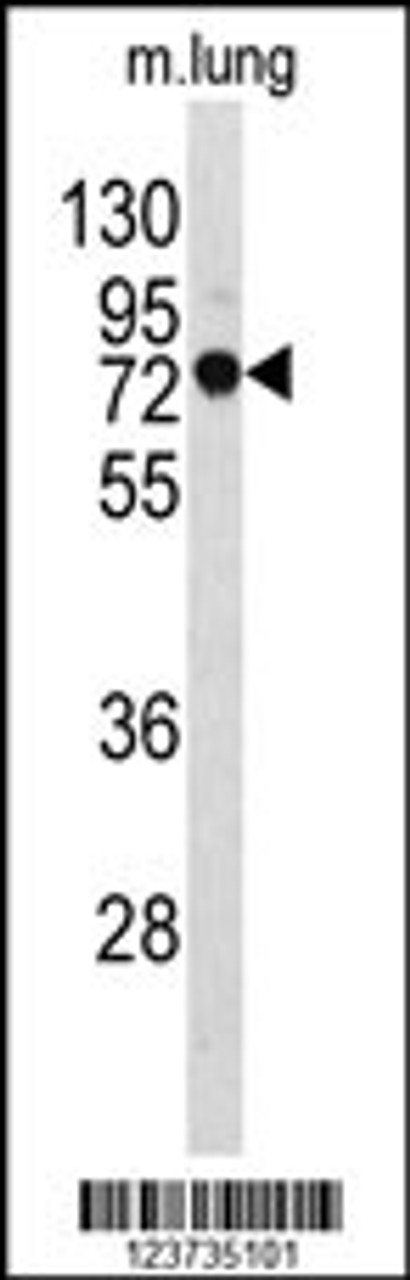 Western blot analysis of EEFSEC Antibody in mouse lung tissue lysates (35ug/lane)