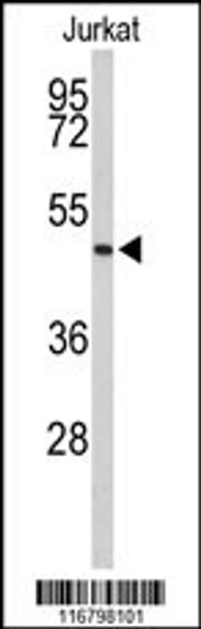 Western blot analysis of ACR Antibody in Jurkat cell line lysates (35ug/lane)