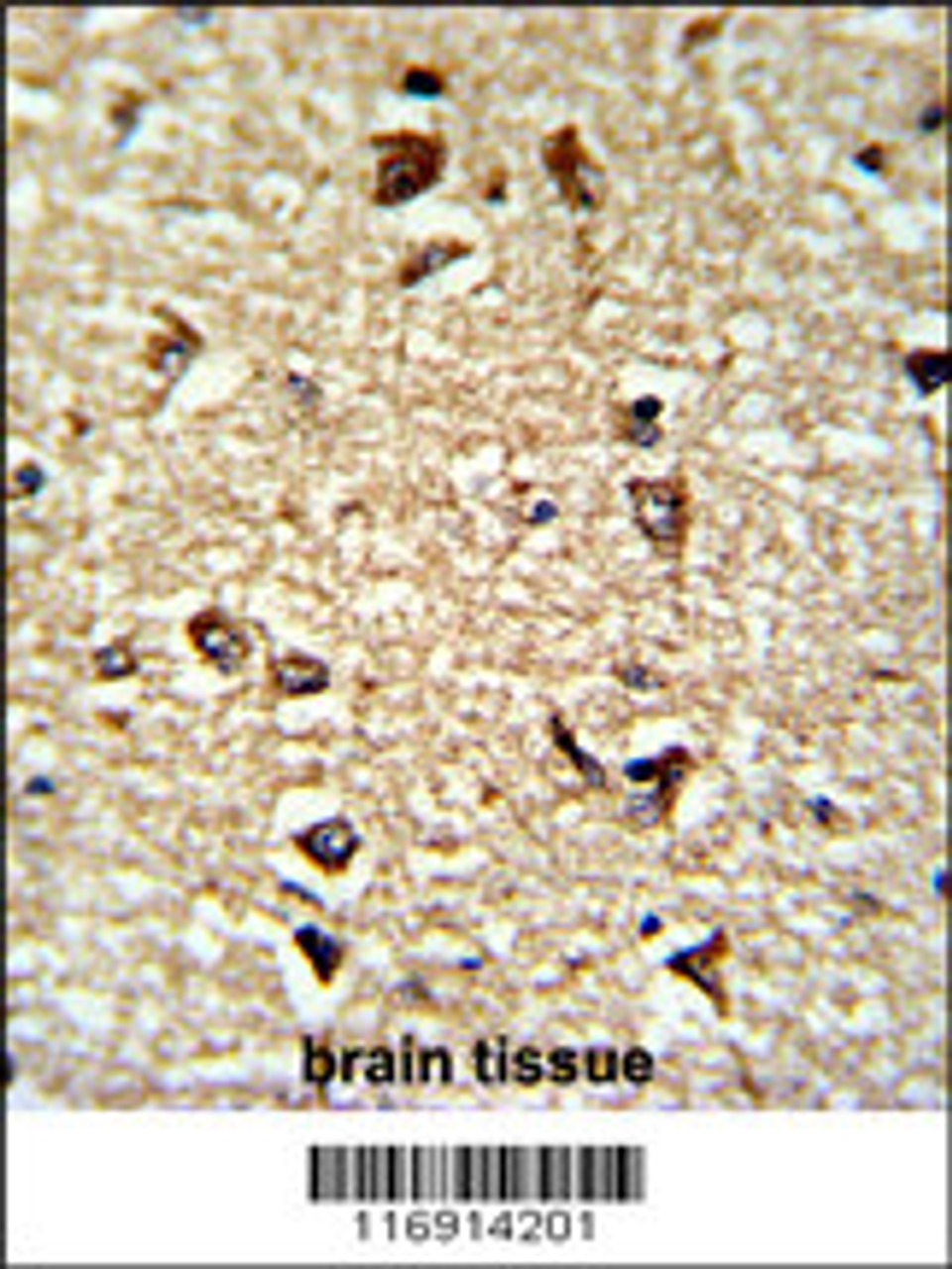Formalin-fixed and paraffin-embedded human brain tissue reacted with CDC2L6 Antibody, which was peroxidase-conjugated to the secondary antibody, followed by DAB staining.