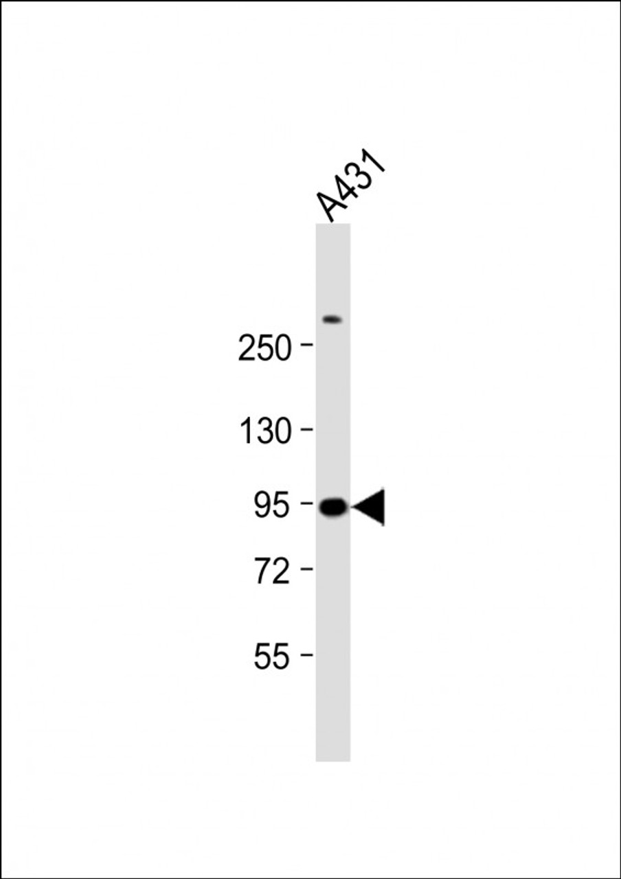 Western Blot at 1:1000 dilution + A431 whole cell lysate Lysates/proteins at 20 ug per lane.