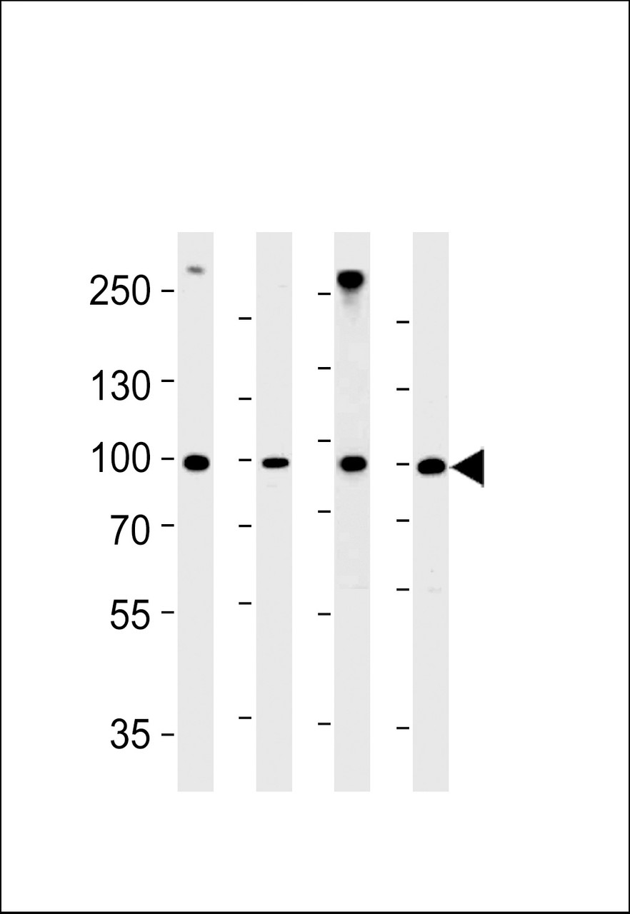Western blot analysis in A431, H-4-II-E, Hela, rat L6 cell line lysates (35ug/lane) .
