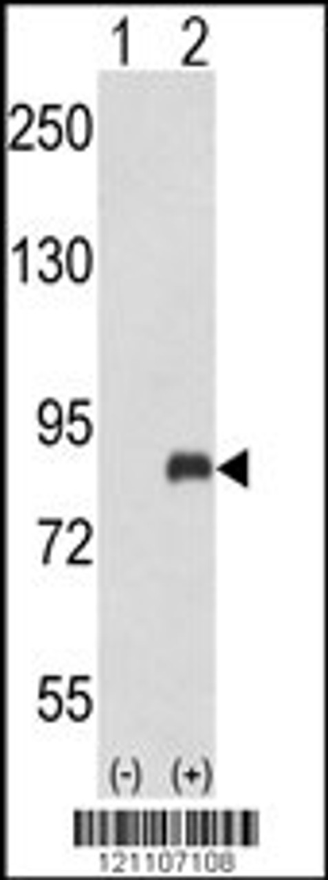 Western blot analysis of ADRBK2 using rabbit polyclonal ADRBK2 Antibody using 293 cell lysates (2 ug/lane) either nontransfected (Lane 1) or transiently transfected with the ADRBK2 gene (Lane 2) .