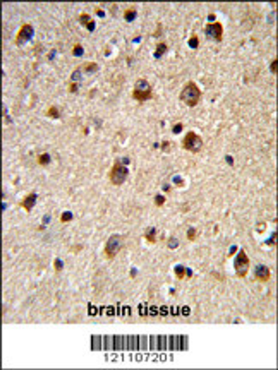 Formalin-fixed and paraffin-embedded human brain tissue reacted with ADRBK2 Antibody (N-term) , which was peroxidase-conjugated to the secondary antibody, followed by DAB staining.
