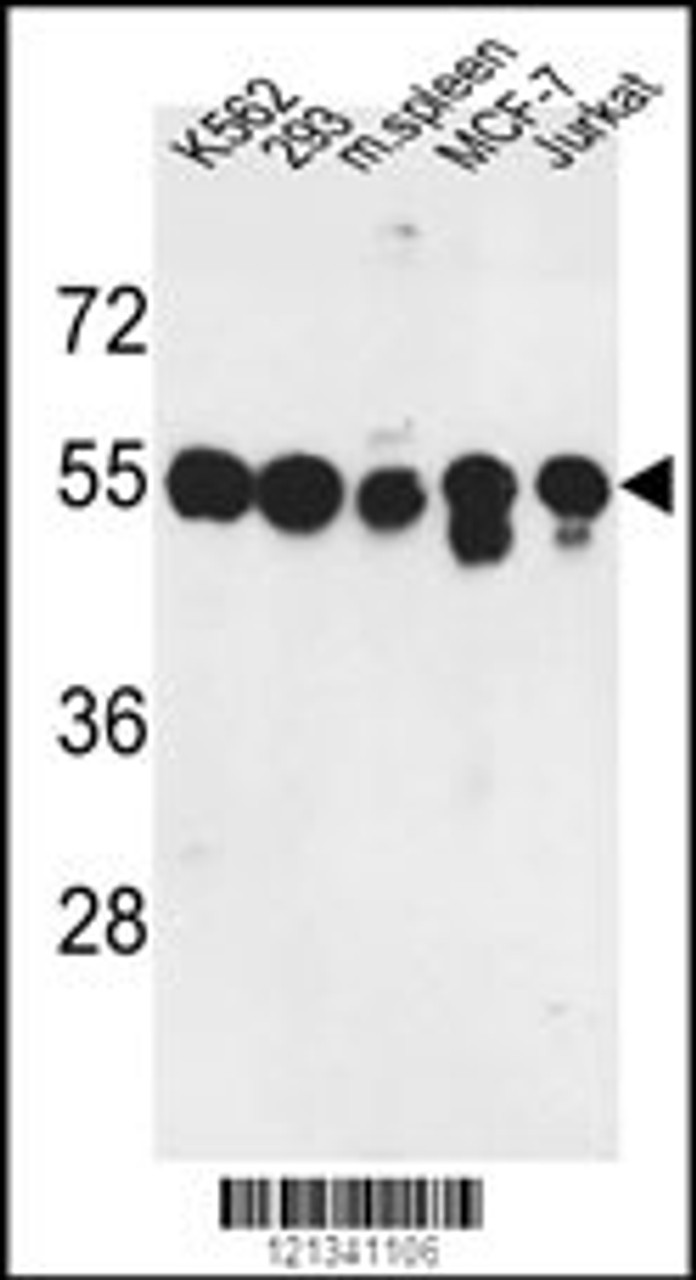 Western blot analysis of PPM1H Antibody in K562, 293, MCF-7, Jurkat cell line and mouse spleen tissue lysates (35ug/lane)