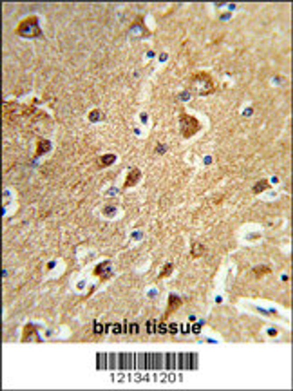 Formalin-fixed and paraffin-embedded human brain tissue reacted with PPM1H Antibody, which was peroxidase-conjugated to the secondary antibody, followed by DAB staining.