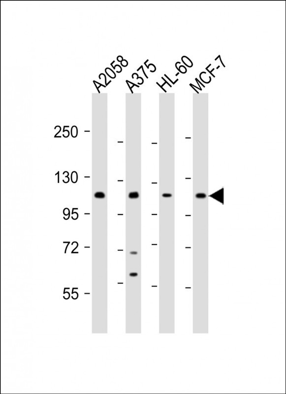 Western Blot at 1:2000 dilution Lane 1: A2058 whole cell lysate Lane 2: A375 whole cell lysate Lane 3: HL-60 whole cell lysate Lane 4: MCF-7 whole cell lysate Lysates/proteins at 20 ug per lane.