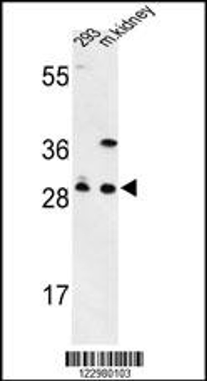 Western blot analysis of GCLM Antibody in 293 cell line and mouse kidney tissue lysates (35ug/lane)