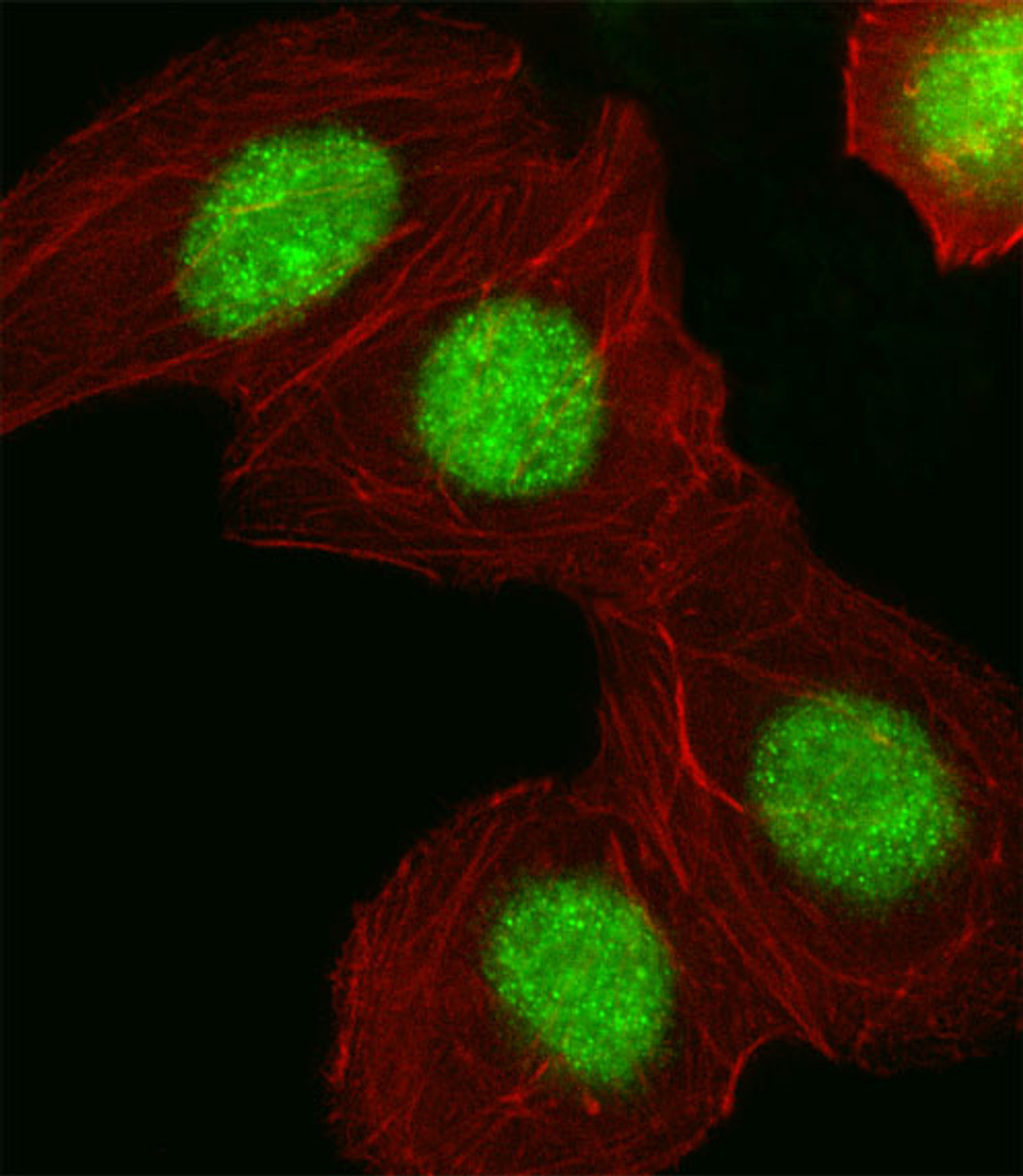 Fluorescent image of A549 cell stained with HMGA1 Antibody .A549 cells were fixed with 4% PFA (20 min) , permeabilized with Triton X-100 (0.1%, 10 min) , then incubated with HMGA1 primary antibody (1:25) . For secondary antibody, Alexa Fluor 488 conjugated donkey anti-rabbit antibody (green) was used (1:400) .Cytoplasmic actin was counterstained with Alexa Fluor 555 (red) conjugated Phalloidin (7units/ml) .HMGA1 immunoreactivity is localized to Nucleus significantly.