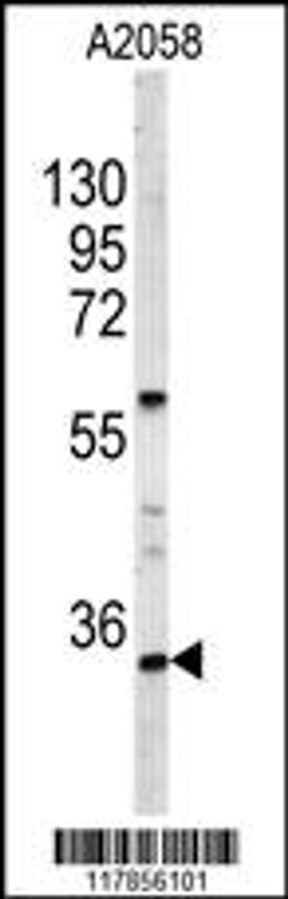 Western blot analysis of HOXA9 Antibody in A2058 cell line lysates (35ug/lane)