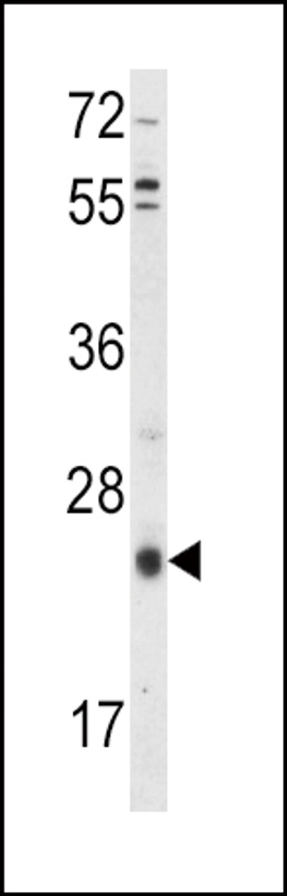 Western blot analysis of TIMP3 Antibody in HepG2 cell line lysates (35ug/lane)