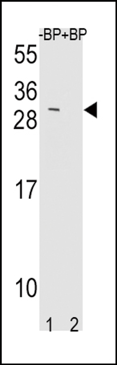 Western blot analysis of TIMP3 Antibody Pab pre-incubated without (lane 1) and with (lane 2) blocking peptide in mouse NIH-3T3 cell line lysate.