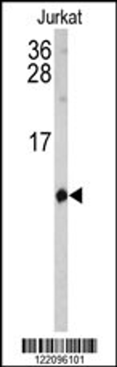 Western blot analysis of SH2D1B Antibody in Jurkat cell line lysates (35ug/lane)