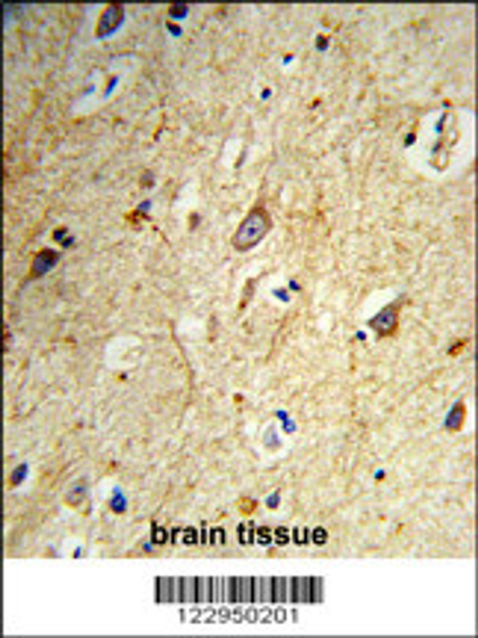Formalin-fixed and paraffin-embedded human brain tissue reacted with GABARAPL1 Antibody, which was peroxidase-conjugated to the secondary antibody, followed by DAB staining.